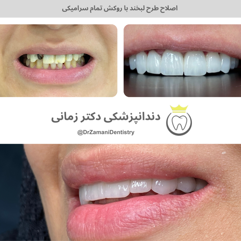 دکتر الهام زمانی امین‌آبادی - gallery