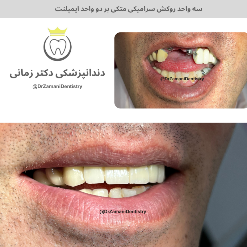 دکتر الهام زمانی امین‌آبادی - gallery