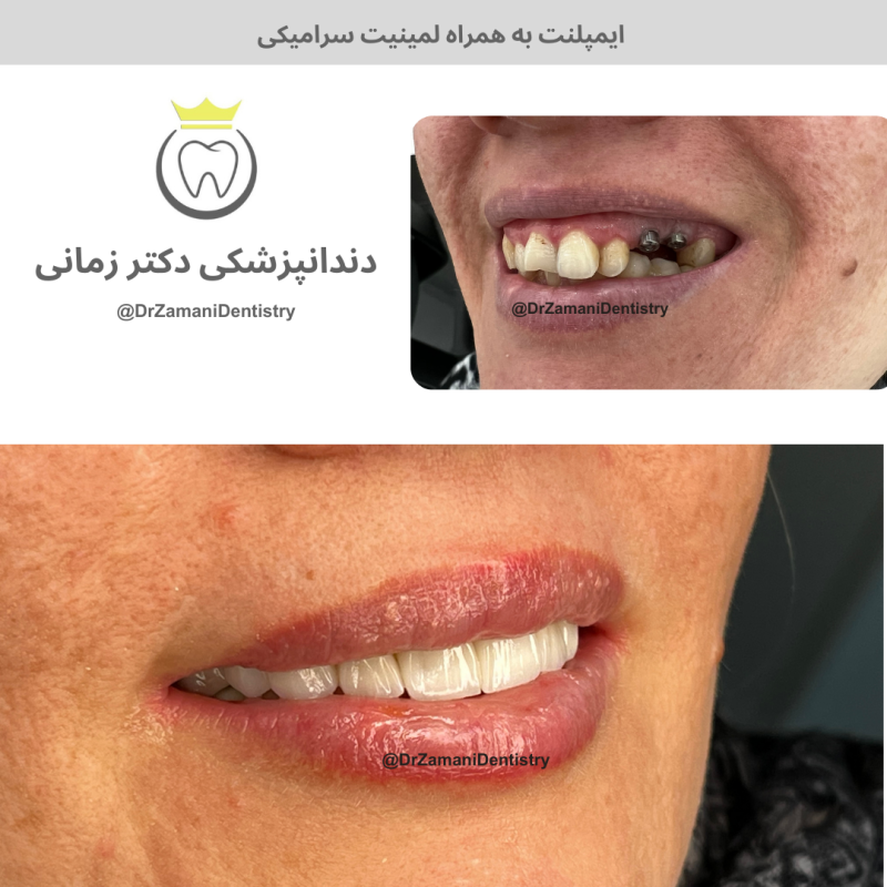 دکتر الهام زمانی امین‌آبادی - gallery