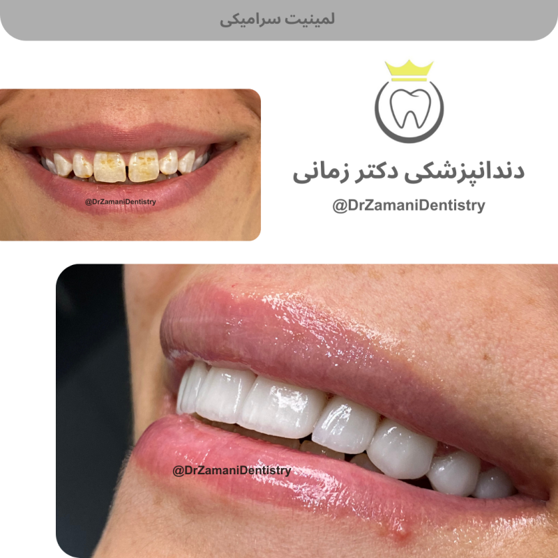 دکتر الهام زمانی امین‌آبادی - gallery